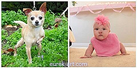 Denne søte jenta og hunden hennes deler den samme sjeldne fødselsdefekten
